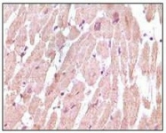 AM06110SU-N - Cardiac Troponin I
