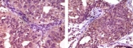 AM06111PU-N - EPHA1