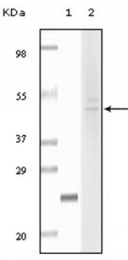 AM06130SU-N - Fibulin-5