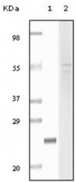 AM06131SU-N - Fibulin-5