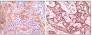 AM06134PU-N - Gamma-Synuclein / SNCG