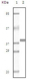 AM06141PU-N - Myoglobin