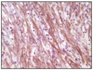AM06142PU-N - Desmin
