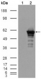 AM06142PU-N - Desmin