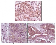 AM06150PU-N - EIF4EBP1 / 4E-BP1
