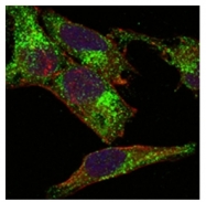 AM06151PU-N - Inhibin alpha / INHA