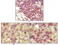 AM06151PU-N - Inhibin alpha / INHA