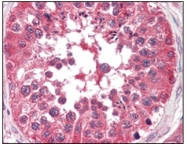 AM06152SU-N - B-Raf proto-oncogene