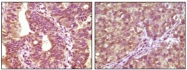 AM06152SU-N - B-Raf proto-oncogene