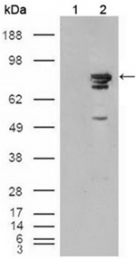 AM06152SU-N - B-Raf proto-oncogene