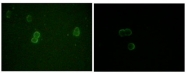 AM06158PU-N - Apolipoprotein M / Apo M