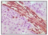 AM06159SU-N - Vimentin