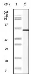 AM06159SU-N - Vimentin