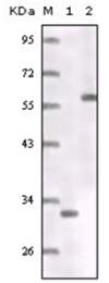 AM06176SU-N - Estrogen receptor alpha