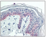 AM06179SU-N - Cytokeratin 5