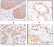 AM06179SU-N - Cytokeratin 5