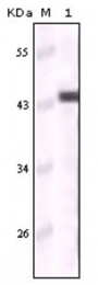 AM06179SU-N - Cytokeratin 5