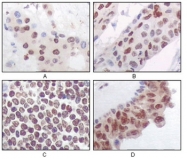 AM06183SU-N - MAPKAP Kinase-5
