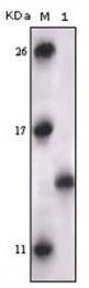 AM06183SU-N - MAPKAP Kinase-5