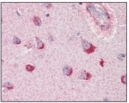 AM06185SU-N - Sortilin-related receptor (SORL1)
