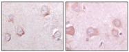 AM06185SU-N - Sortilin-related receptor (SORL1)