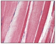 AM06186SU-N - CD167b / DDR2