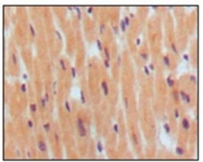 AM06191SU-N - Natriuretic peptides B