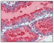 AM06205SU-N - Kallikrein-3 / PSA / KLK3