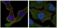 AM06211SU-N - Calreticulin