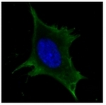 AM06211SU-N - Calreticulin