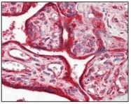 AM06211SU-N - Calreticulin