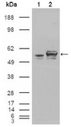 AM06211SU-N - Calreticulin