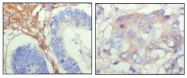 AM06223SU-N - Fibulin-5