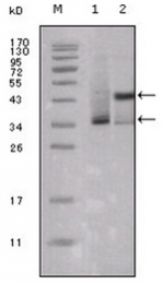 AM06229SU-N - Estrogen receptor alpha