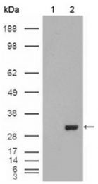 AM06244SU-N - Carbonic anhydrase 1