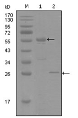 AM06274SU-N - Progesterone receptor