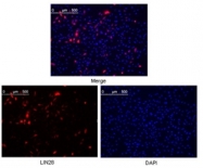 AM06277PU-N - LIN28