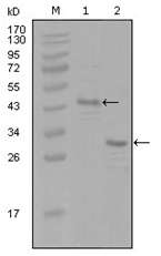 AM06278SU-N - Estrogen receptor alpha
