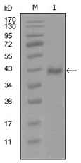 AM06279SU-N - Androgen receptor