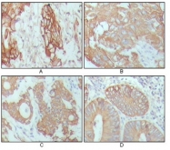 AM06282SU-N - Cytokeratin 18