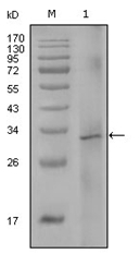 AM06283SU-N - Coagulation factor VIII (F8)