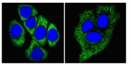 AM06284SU-N - Cytokeratin 8