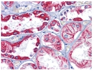AM06284SU-N - Cytokeratin 8