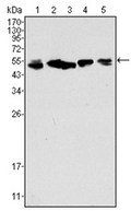 AM06284SU-N - Cytokeratin 8