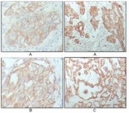 AM06284SU-N - Cytokeratin 8