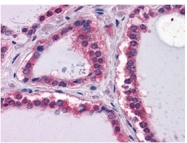 AM06291SU-N - Laminin beta-1 / LAMB1