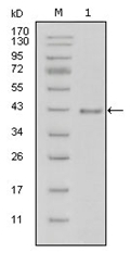 AM06291SU-N - Laminin beta-1 / LAMB1