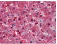 AM06297SU-N - Apolipoprotein(a) / LP(a)