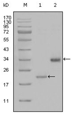 AM06297SU-N - Apolipoprotein(a) / LP(a)