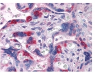 AM06298SU-N - PEG10